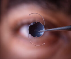 ORA system for cataract surgery